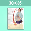 Плакат «Что такое метаболический синдром?» (ЗОЖ-05, ламинированная бумага, A2, 1 лист)